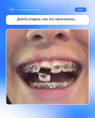 Травма после падения с велосипеда — тактика стоматолога.